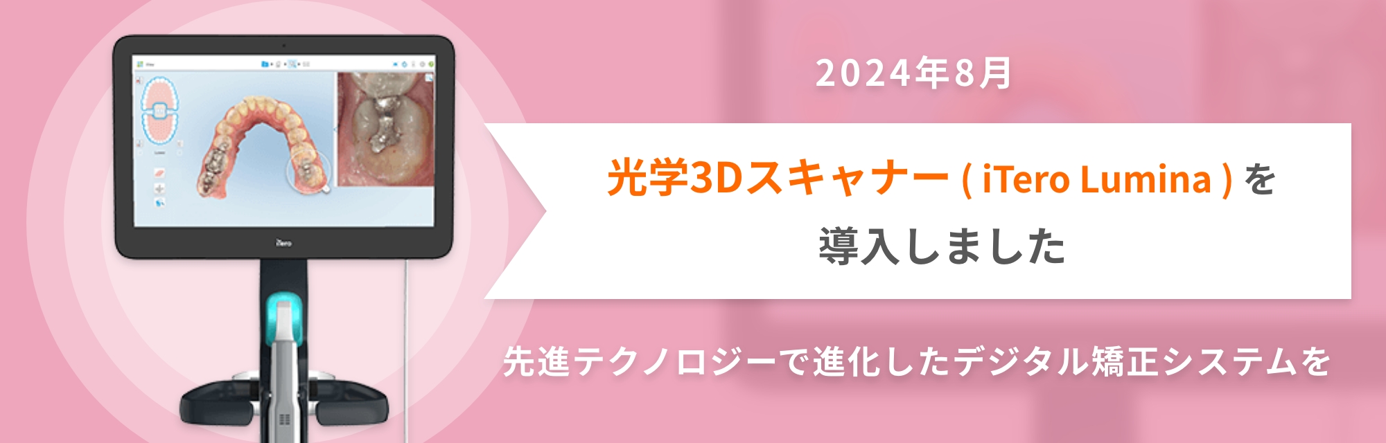 光学3Dスキャナー（iTero Lumina）を導入しました