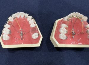 株式会社プロシードが販売している「デュアルトップ」